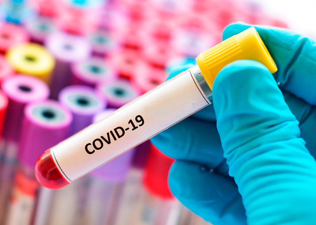 El Ayuntamiento confirma 206 nuevos casos de coronavirus en Sinop en menos de una semana – Só Notícias